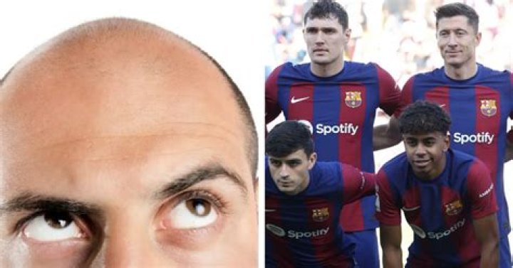 Discoveries And Insights Into "Bald Barcelona Player"