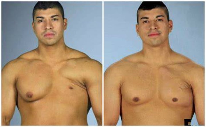 Insane Botched transformations from 'zombie boobs' to deflated disaster